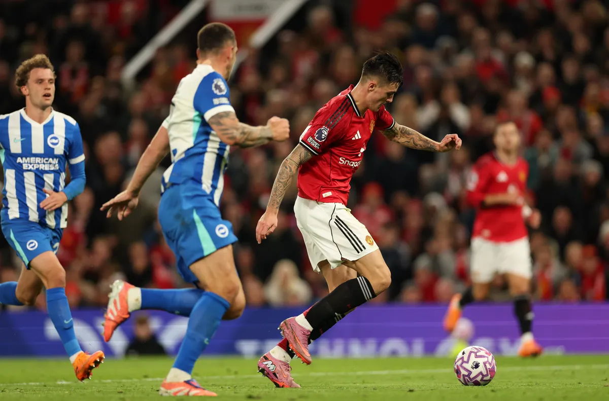 В Юнайтед цари оптимизъм за контузията на Шешко