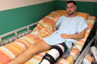 Халф на Локомотив Пловдив претърпя операция
