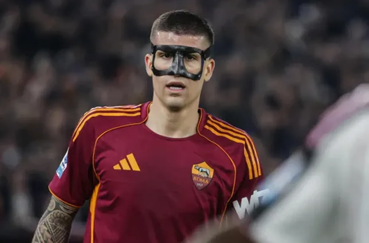 Италиански национал ще липсва поне два мача за Рома