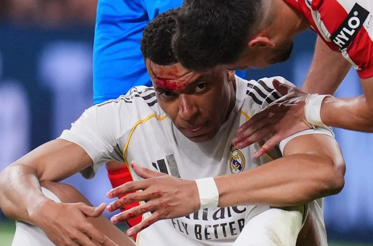 Мбапе без маска срещу Байерн