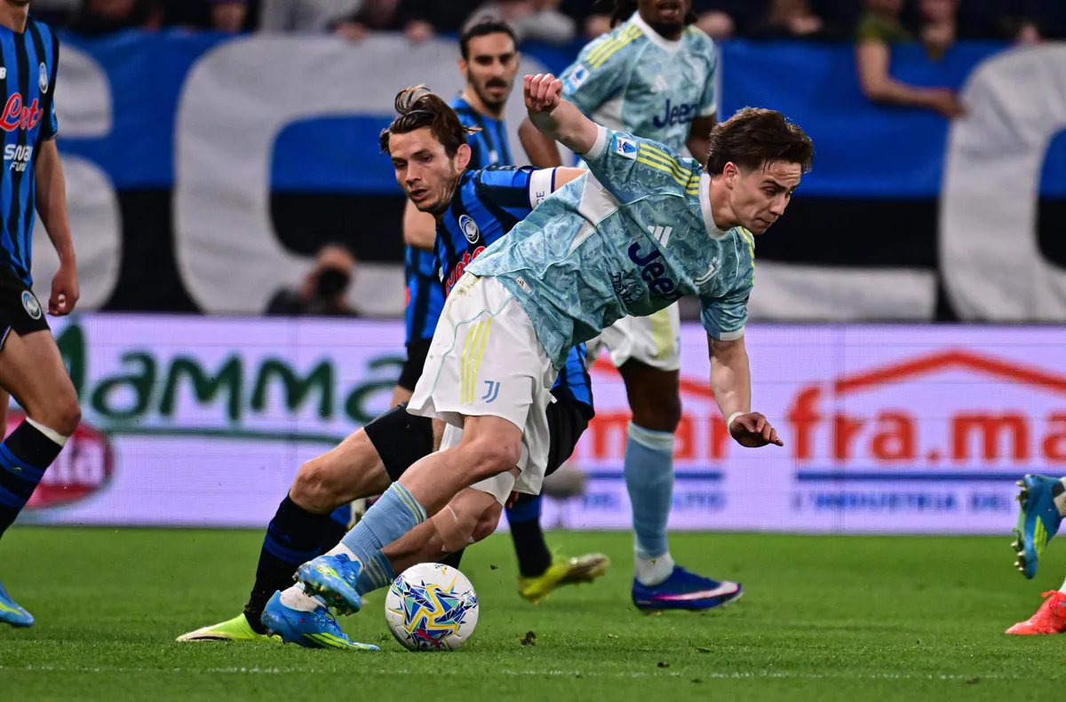 Йълдъз не тренира с Ювентус заради болка в коляното